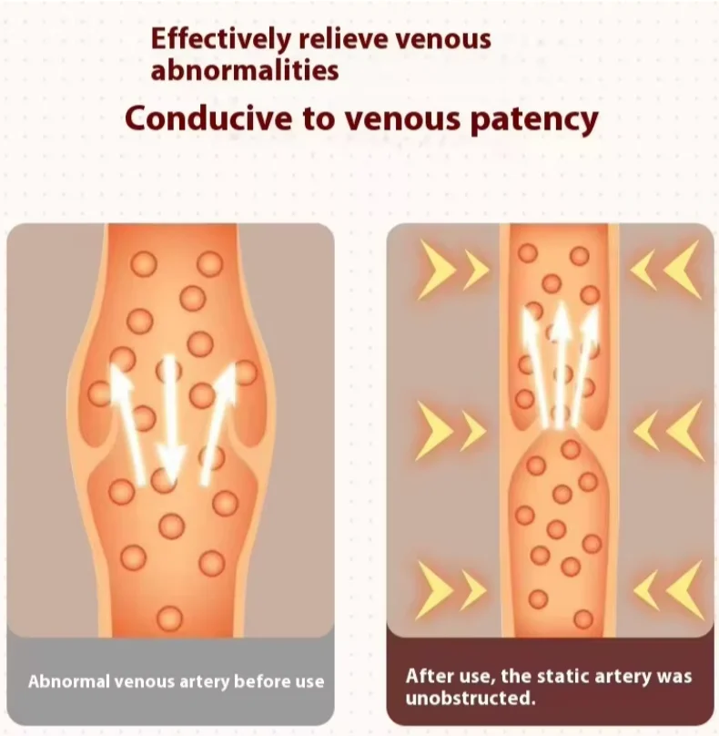 VentiFlex™ Massager